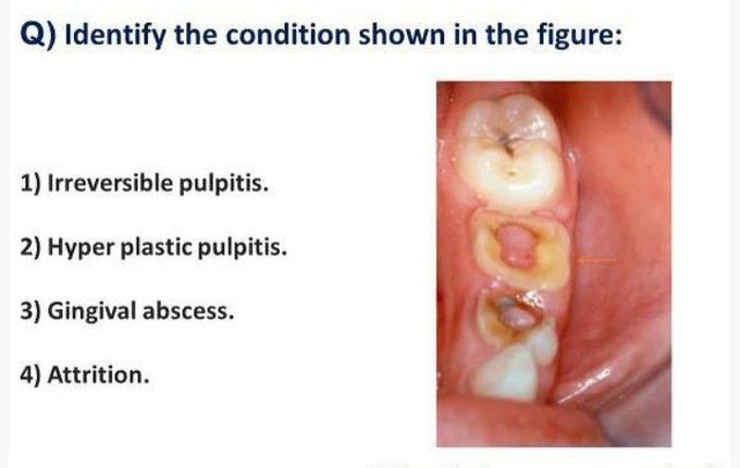 Identify the condition