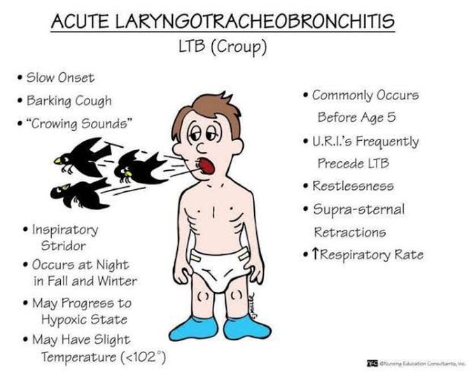 Acute laryngotracheobronchitis (Croup)