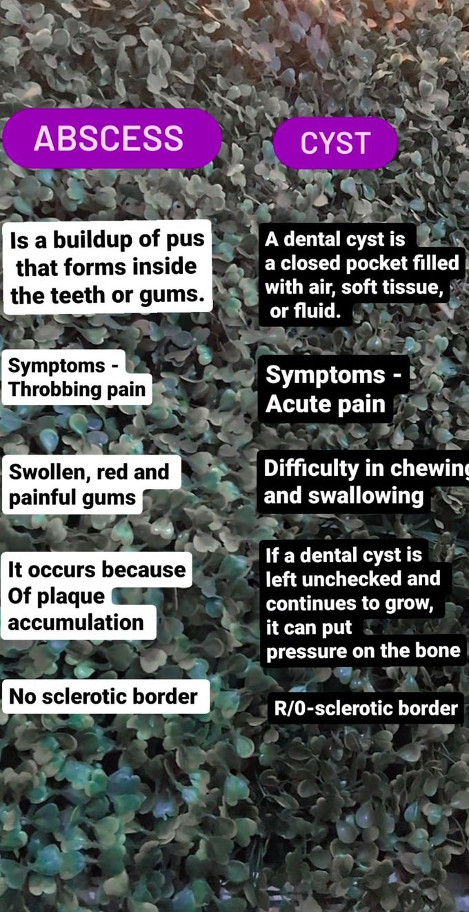 Abscess Vs Cyst