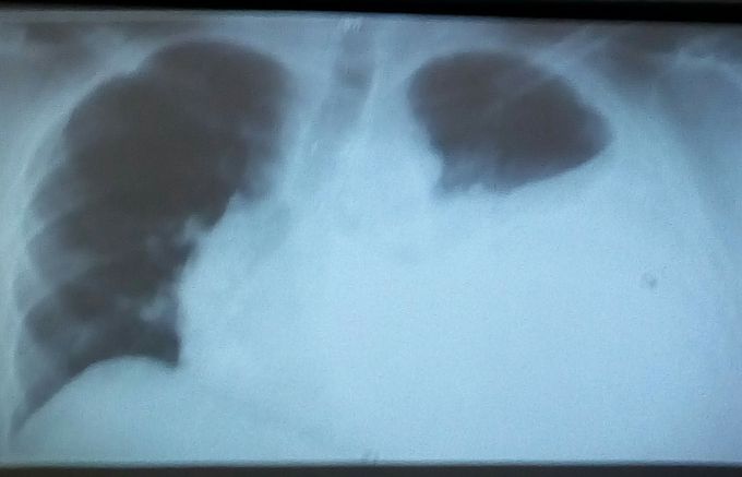 What do you think this rx is?