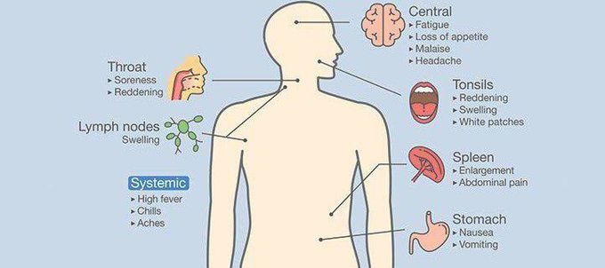 These are the symptoms of Lemeirre's syndrome