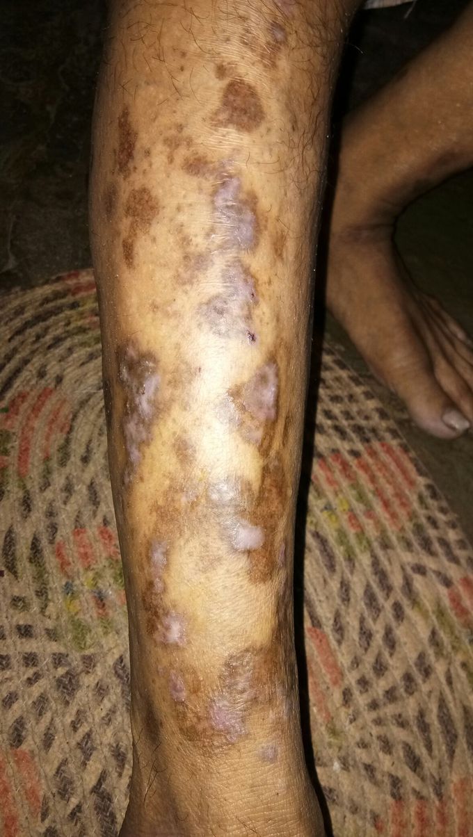Diagnosis please.name the disease please