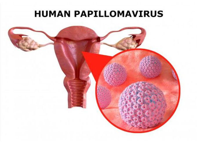 HPV (Human Papillomavirus)