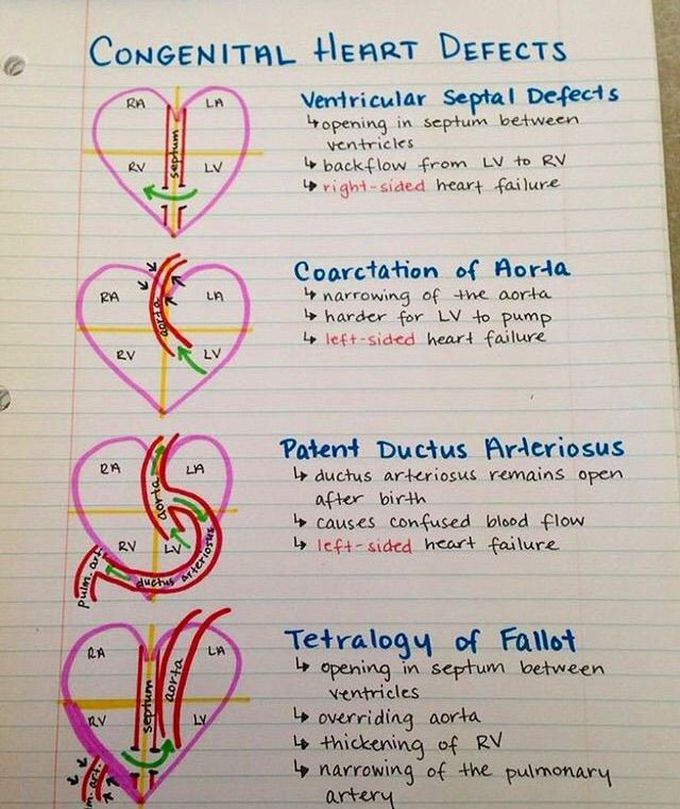 Main Congenital Heart Disease