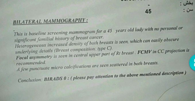 45 years old female with breast cancer