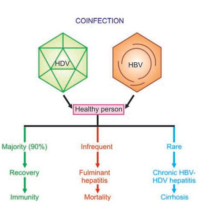 Coinfected hepatitis