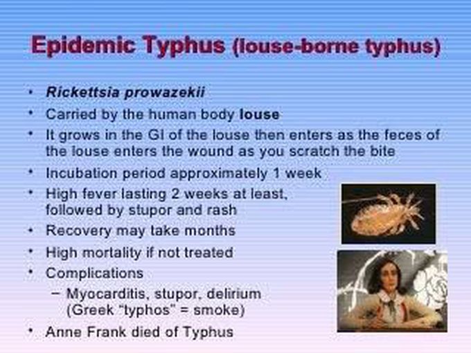 Louse borne typhus