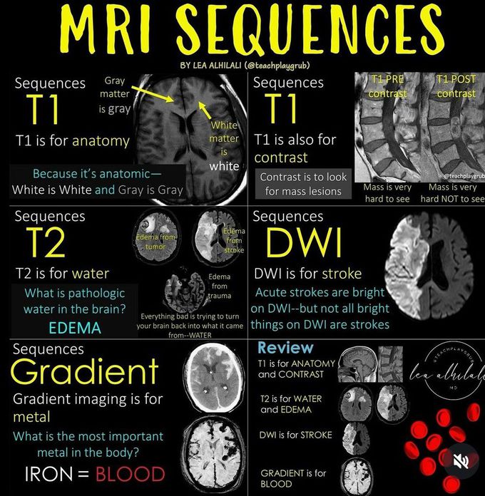 MRI Sequences