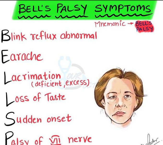 Symptoms of bell's palsy