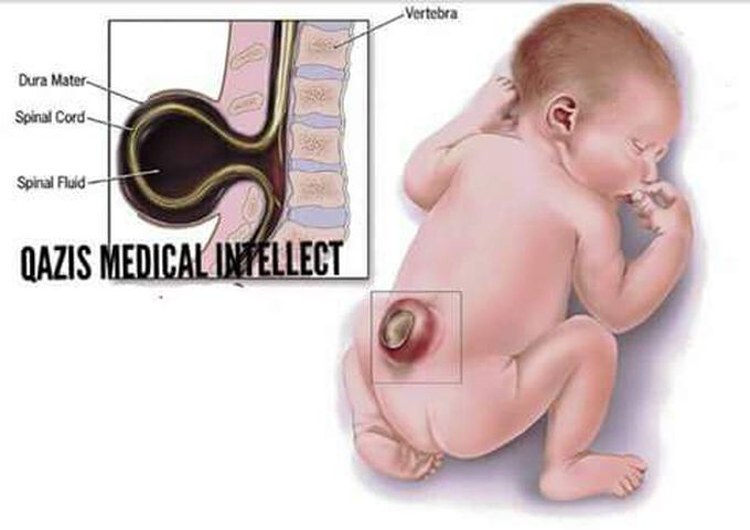 What is the Dx ?
