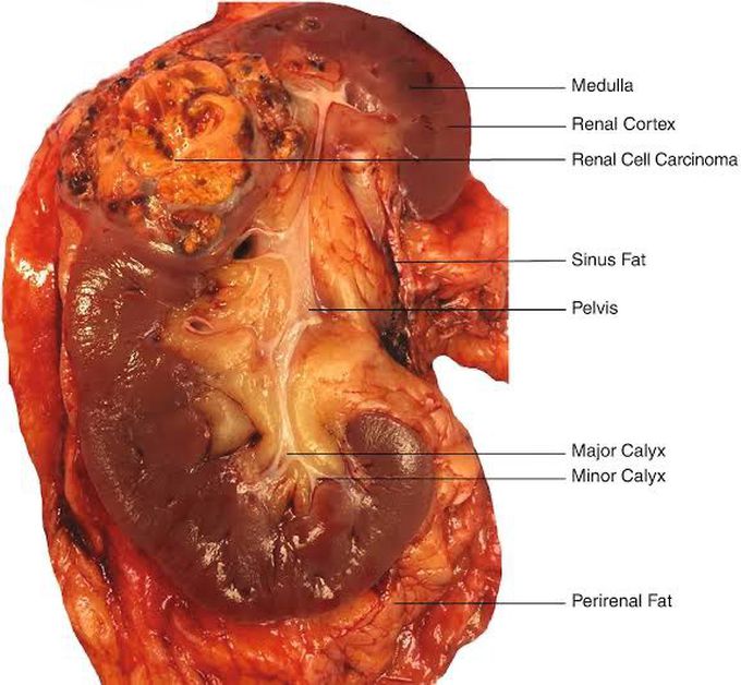 Anatomy of kidney