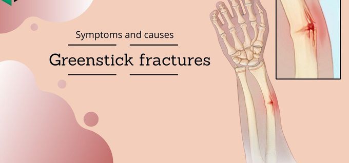 Symptoms of Greenstick Fracture