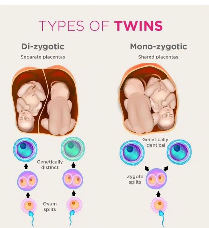 Types of Twins