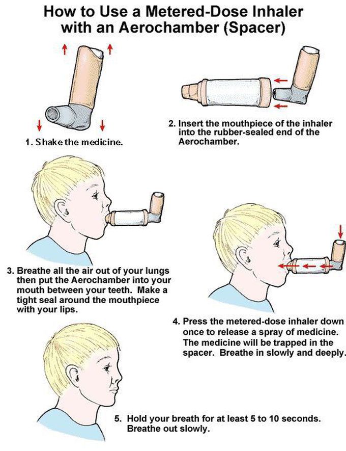 Inhaler technique