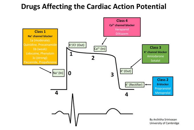 Arrhythmia