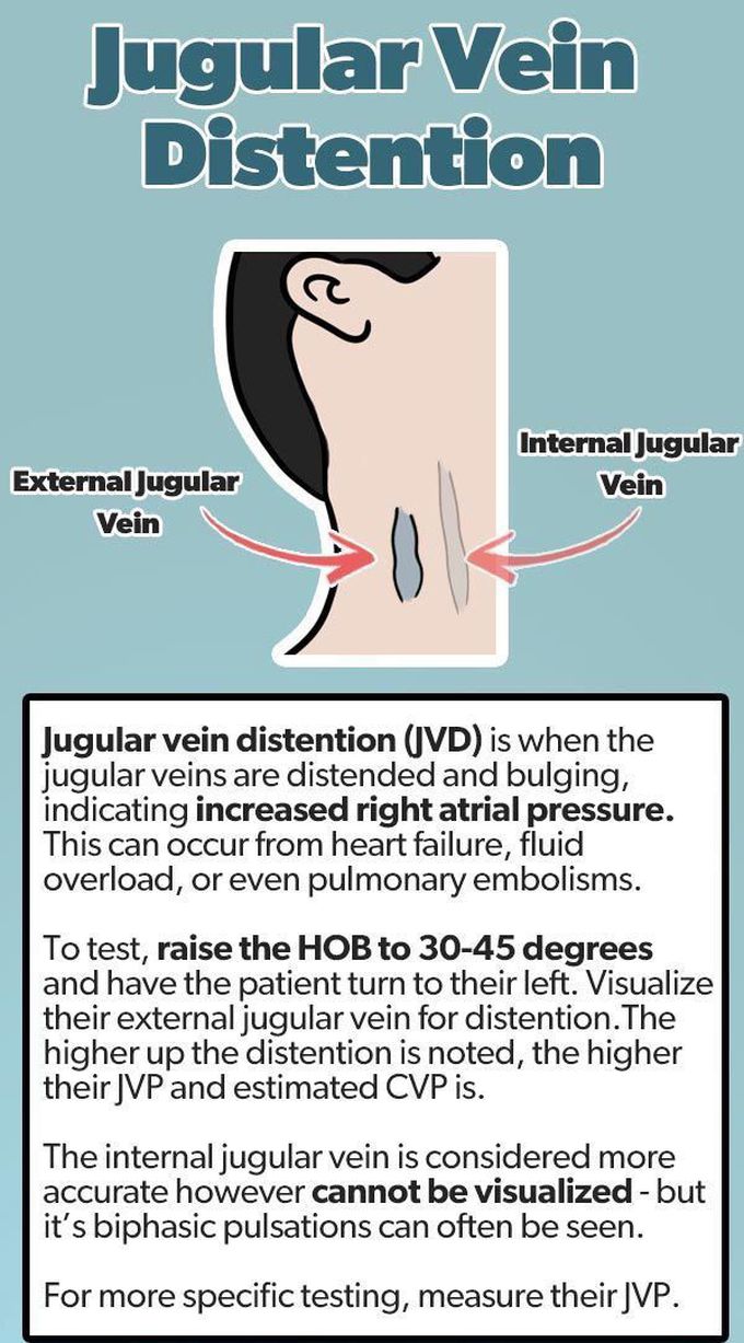 carotid versus jugular venous distention