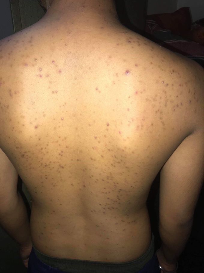 Diagnosis ???
