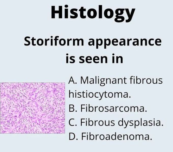 Storiform appearance