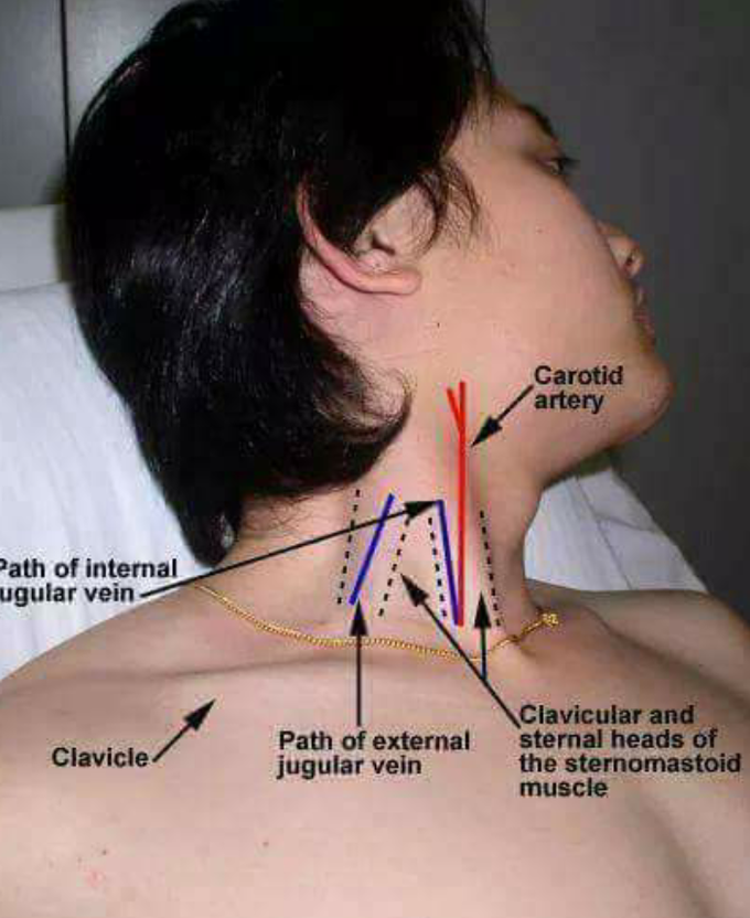 Vessels of neck - MEDizzy