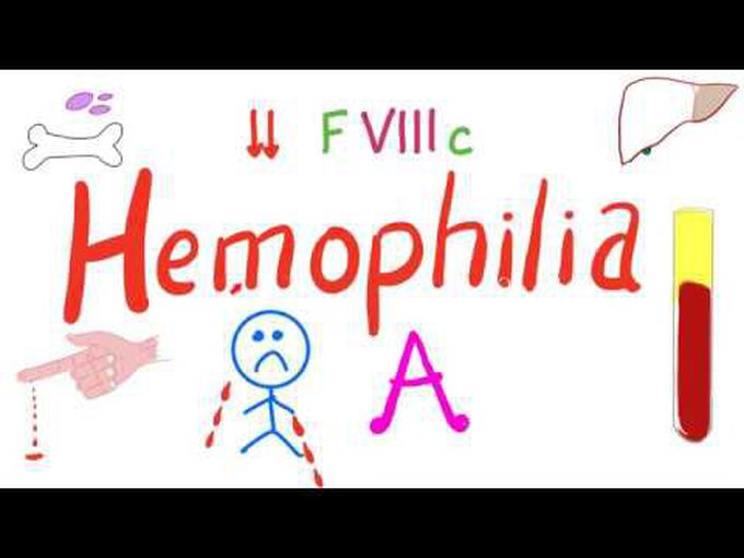 Hemophilia A