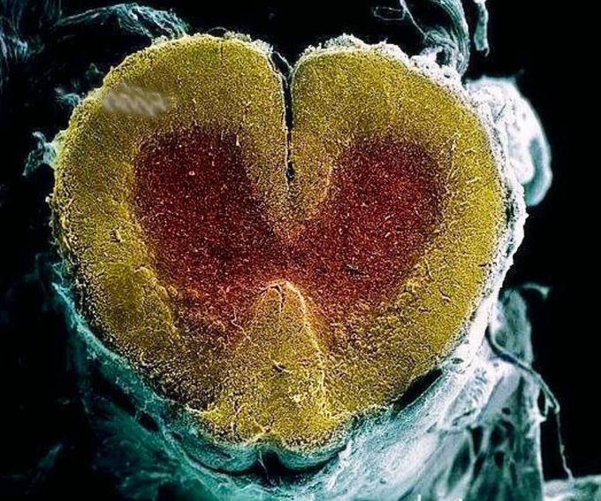 Coloured scanning electron micrograph (SEM) of a cross section through the spinal cord.  