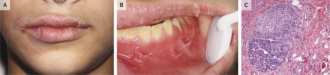 Clinical_Case