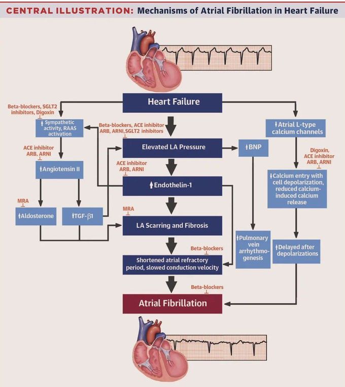 Mechanism of A-Fib