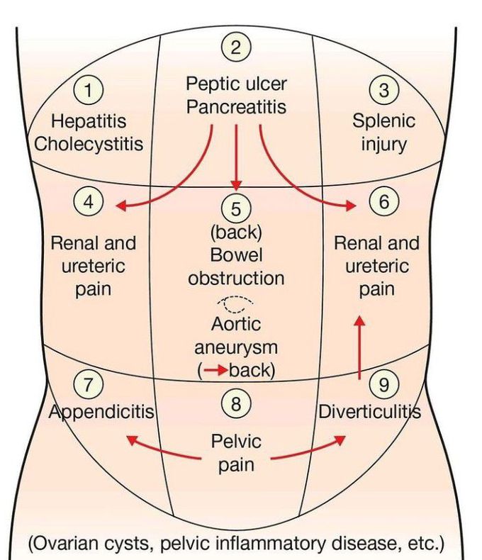 Pain associated with abdominal quadrants
