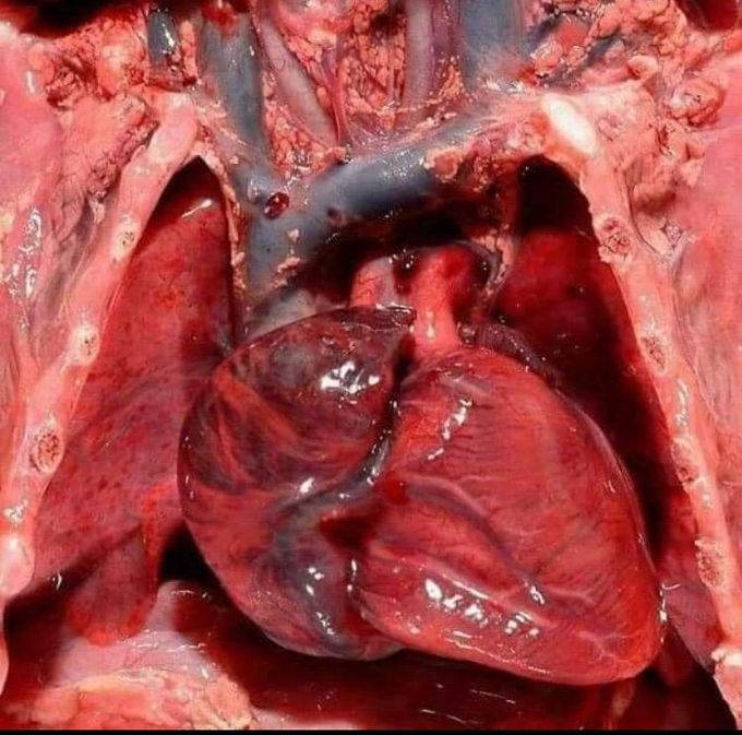 Thorax cavity