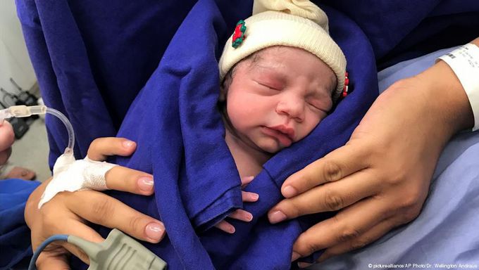 First baby born via uterus transplanted from dead donor