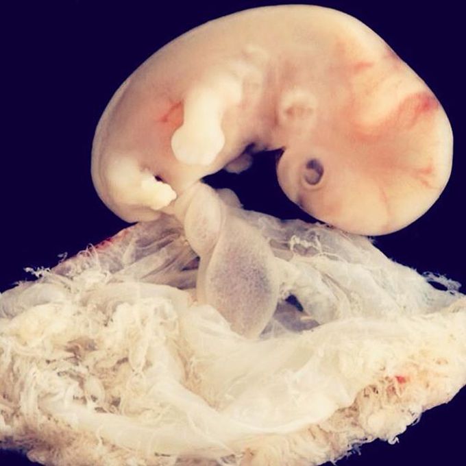 6-7 Weeks Embro