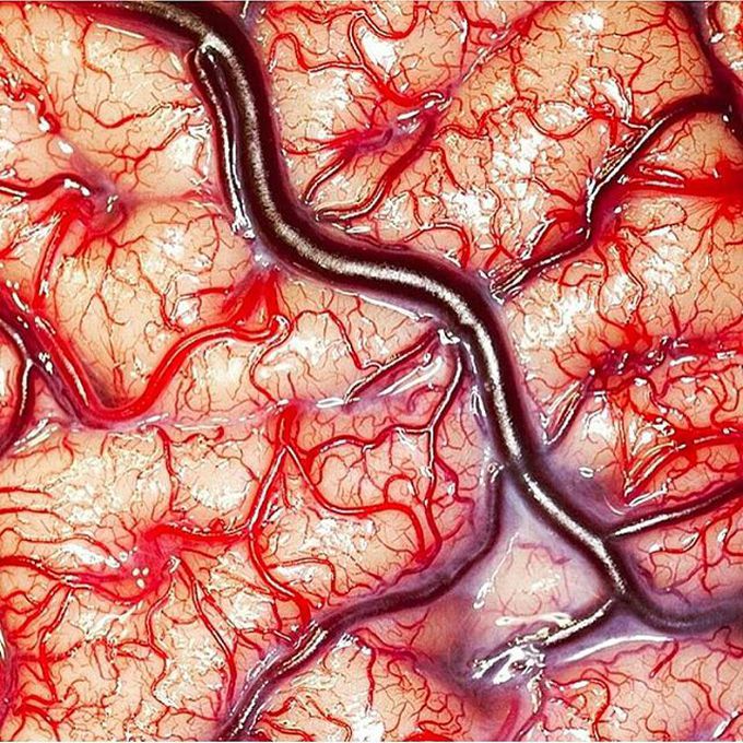 What an amazing capture of the brain's vasculature! - MEDizzy