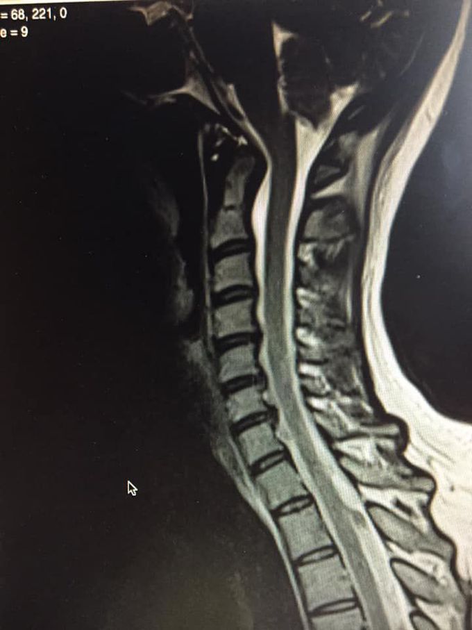 Supine MRI