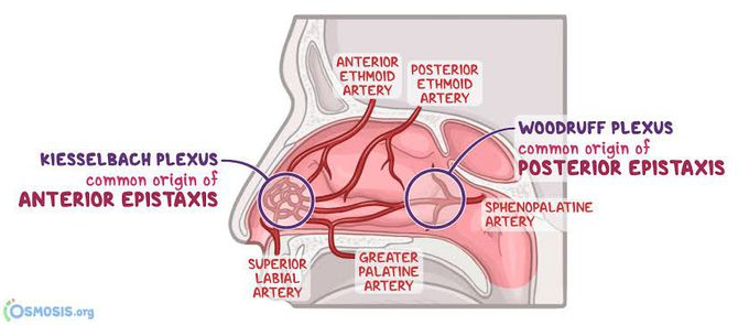 Epistaxis