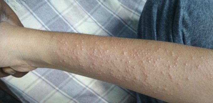 Skin disease - MEDizzy