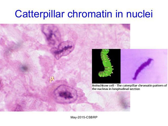 Antischkow cell