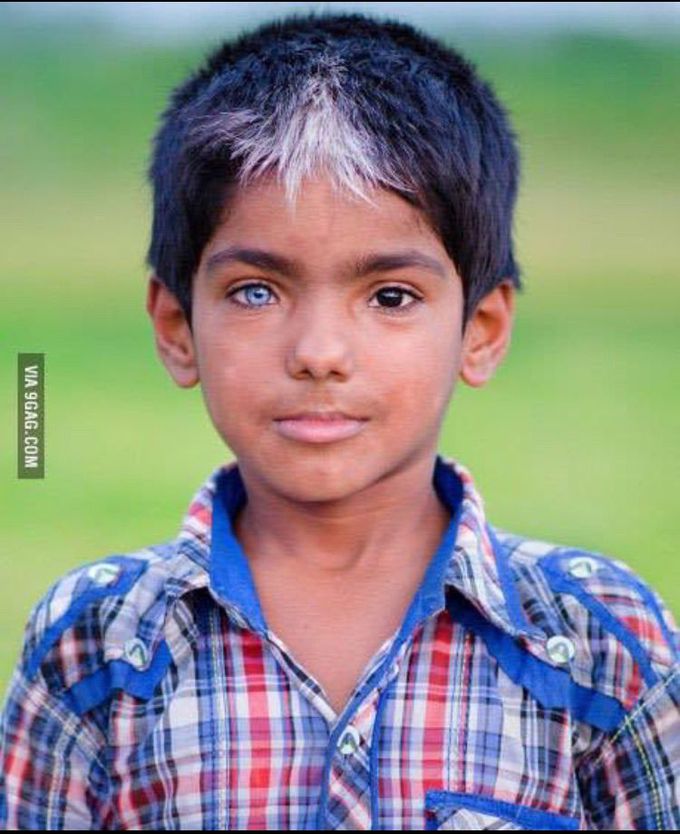 What is the name of this condition??