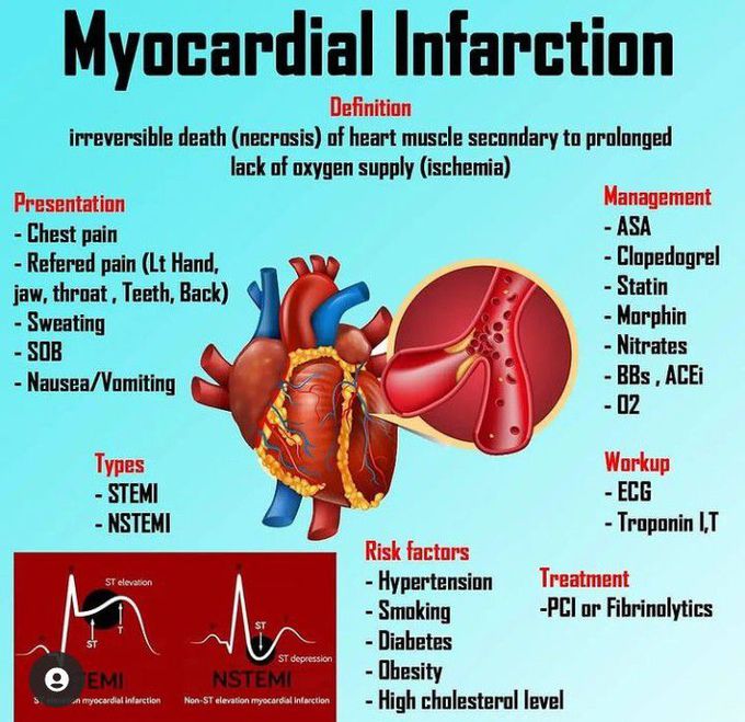 Myocardial infarction