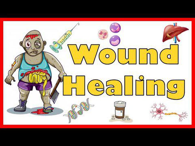 Wound Healing