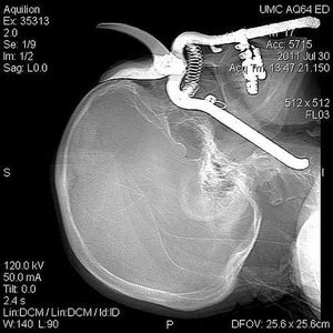 Gardener accident - MEDizzy