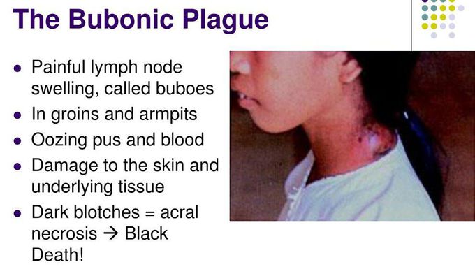 Bubonic plague