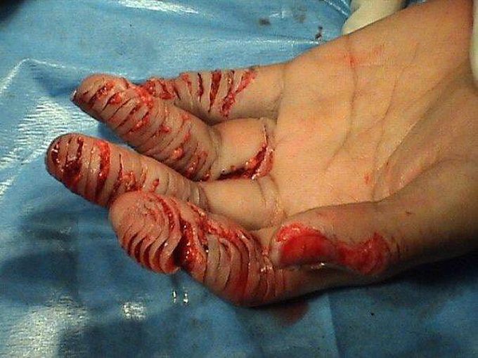 Hand caught in a paper shredder! 