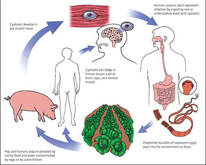 Cause of Neurocysticercosis