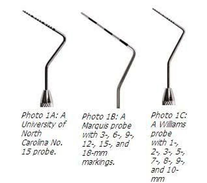 periodontal probe markings