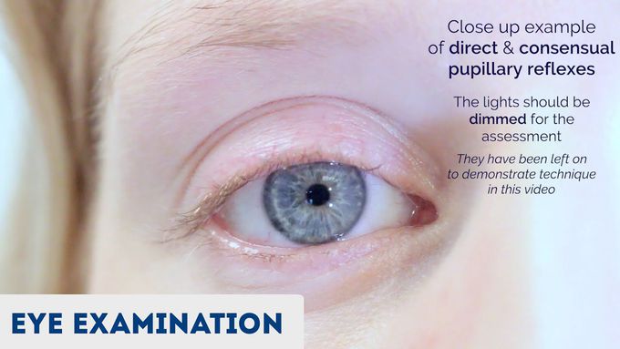 Eye Examination and Vision Assessment - OSCE Guide