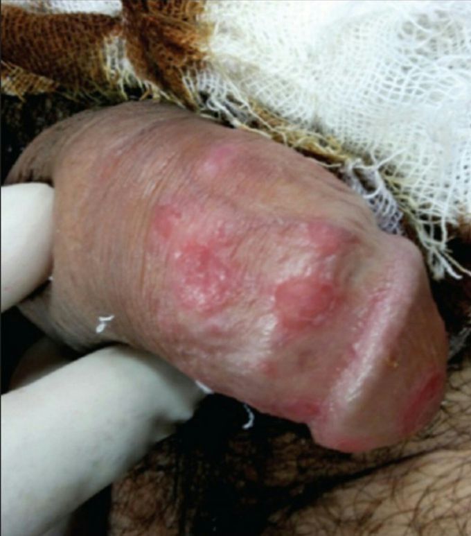 What's your dx?