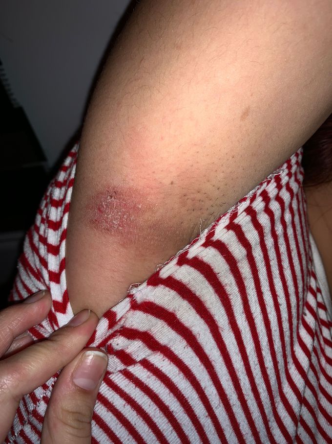 Help woman need diagnosis