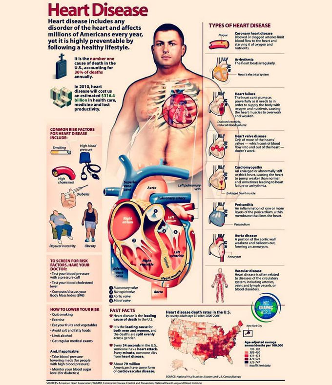 Heart disease