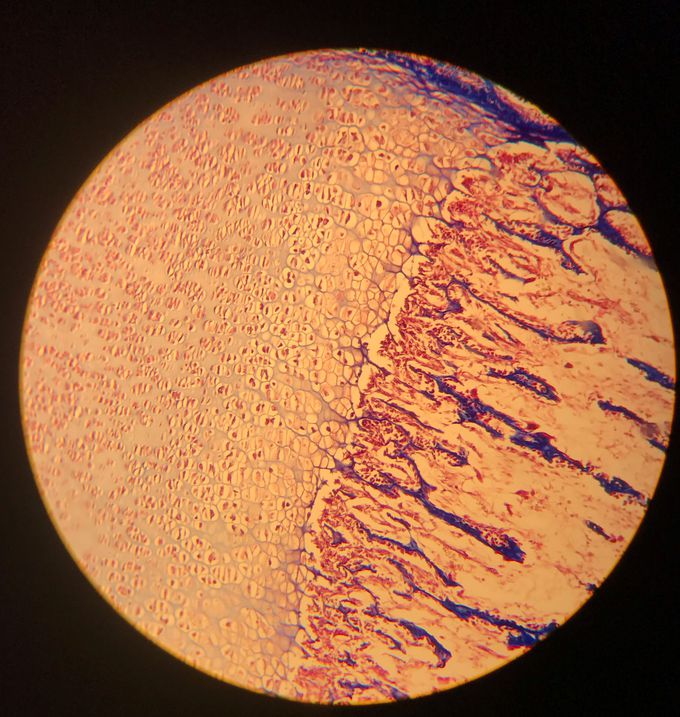 The endochondral ossification ☠️☠️☠️