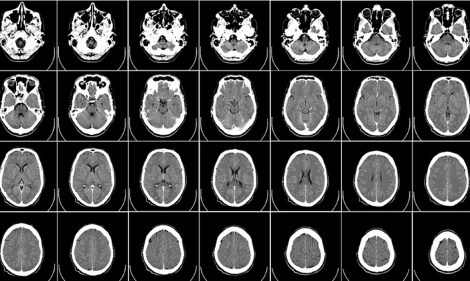 Artificial Intelligence Can Now Manipulate Medical Images Well Enough To Kill People